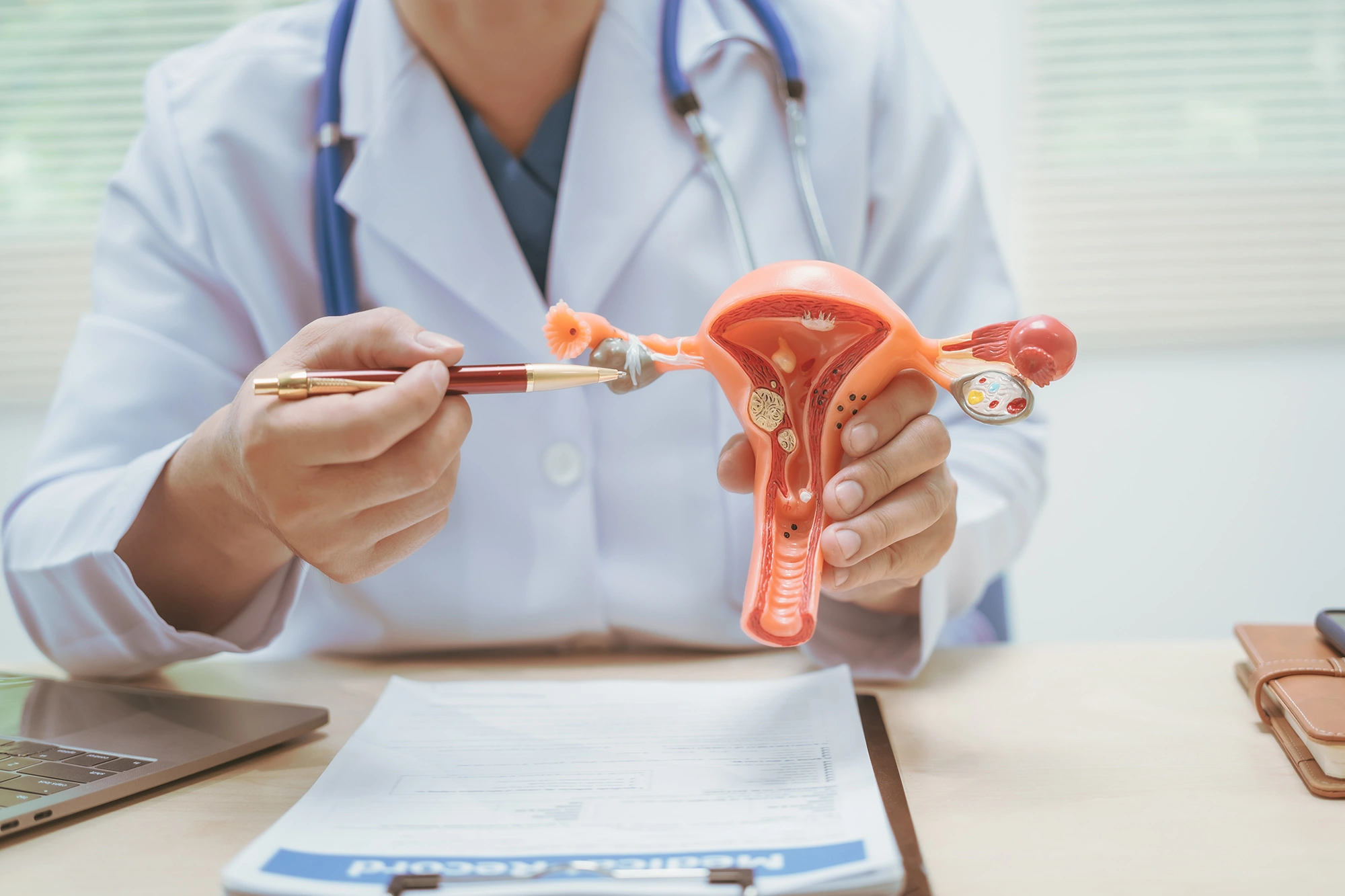 Laparoscopic vs Open Surgery for Ovarian Cysts