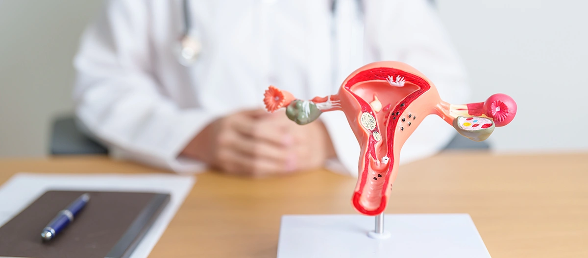 Gynaecologist with a model of the uterus
